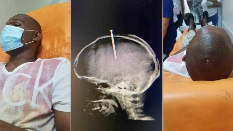 Hombre drogado se martilla clavo de cinco pulgadas en el cráneo